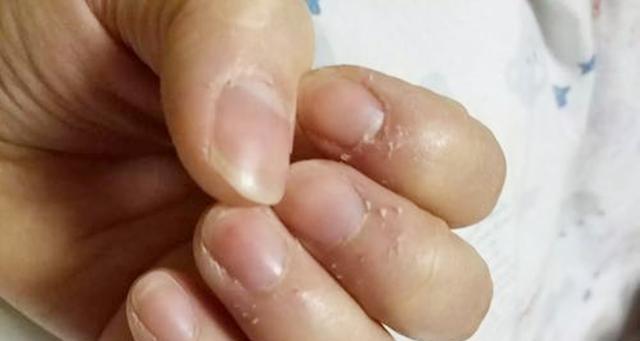 如何正确剪指甲，让宠物舒适无压力（以丝毛梗为例，掌握正确的指甲剪裁技巧）