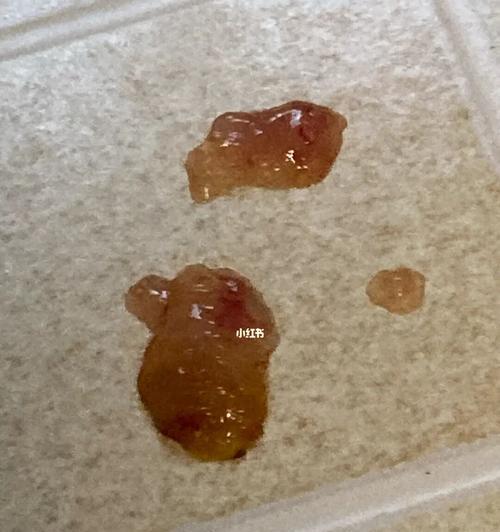 狗狗便便有虫怎么办？找到解决方法！（宠物养护必备知识，不容忽视的便便清理问题！）
