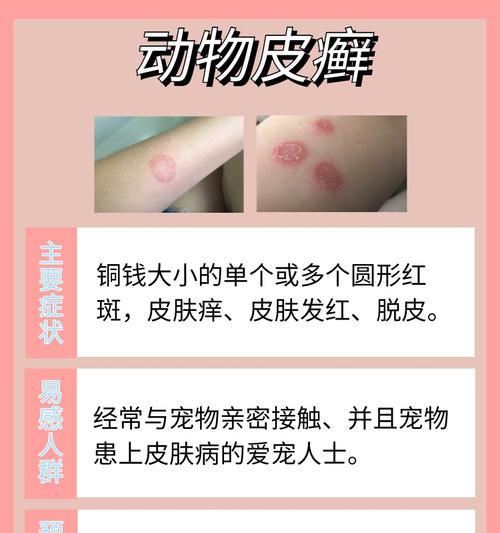 掌握宠物各种皮肤病治疗方法（了解狗狗皮肤病的识别与治疗技巧）