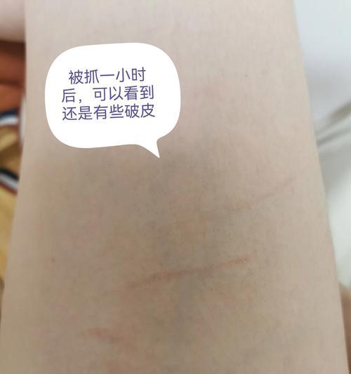 如何判断狗狗是否打过疫苗？（三个简单的方法帮你确认狗狗的疫苗情况）