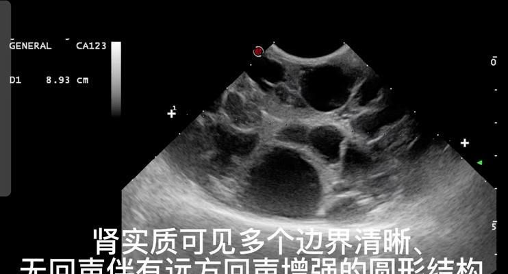 介绍: