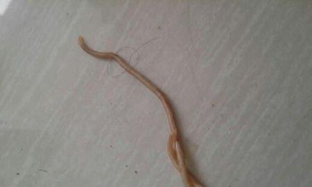 狗狗拉出细长的虫子，可能是什么虫？（了解狗狗可能感染的细长虫子及处理方法）