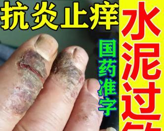 以泰迪脓皮擦的药物治疗研究（以泰迪脓皮擦的有效药物和治疗方法分析）