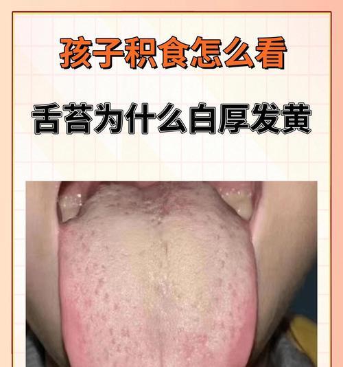 舌头白的原因和治疗方法（揭秘舌苔白的健康隐患与应对之策）