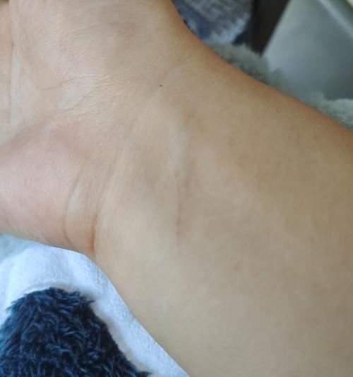猫咪打疫苗的重要性（掌握猫咪打疫苗的关键部位）