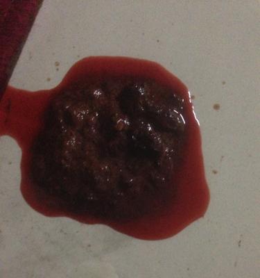 狗拉血是什么病？（了解狗拉血的病因和治疗方法）