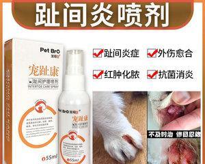 趾间炎治疗的最佳药物选择（了解以趾间炎用什么药最好的关键）