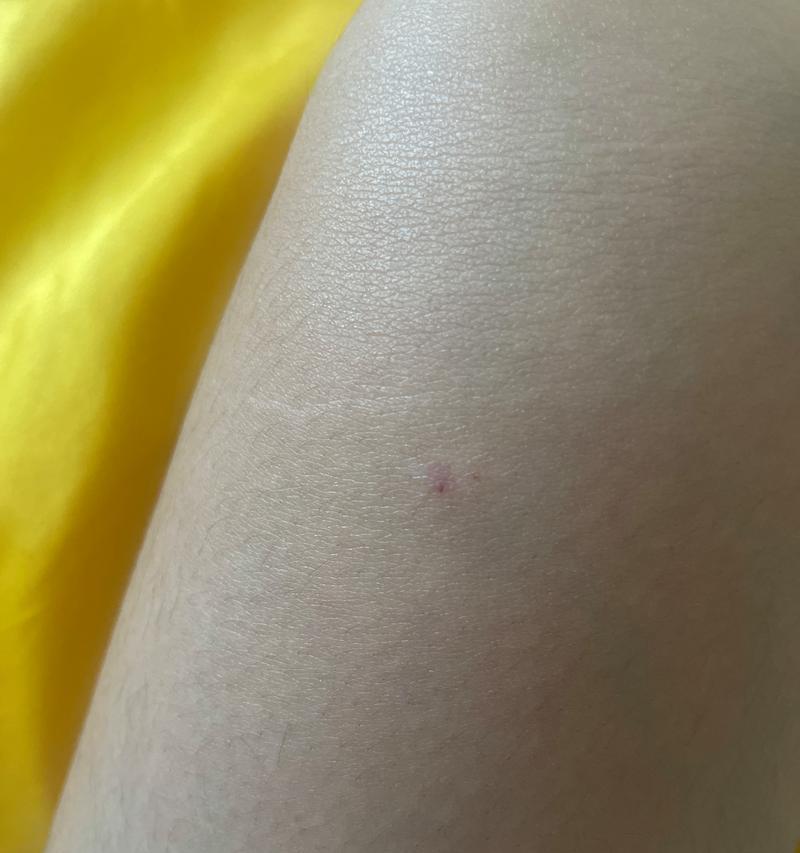 如何防止被猫抓？（有效方法让你与猫咪和谐相处）
