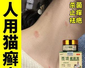 猫癣治疗药物的选择与使用（如何选择适合的药物来治疗猫癣）