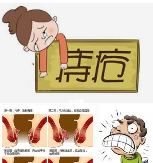 狗狗得了痔疮怎么办？——有效的治疗方法和预防措施